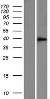 ZFAND3 / TEX27 Protein - Western validation with an anti-DDK antibody * L: Control HEK293 lysate R: Over-expression lysate