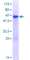 ZFAND3 / TEX27 Protein - 12.5% SDS-PAGE of human ZFAND3 stained with Coomassie Blue