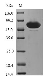 ZFAND3 / TEX27 Protein - (Tris-Glycine gel) Discontinuous SDS-PAGE (reduced) with 5% enrichment gel and 15% separation gel.