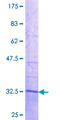 ZFAND3 / TEX27 Protein - 12.5% SDS-PAGE Stained with Coomassie Blue.