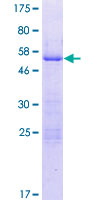 ZFAND5 Protein - 12.5% SDS-PAGE of human ZFAND5 stained with Coomassie Blue