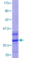 ZFAND5 Protein - 12.5% SDS-PAGE Stained with Coomassie Blue.