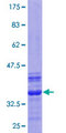 ZFAND5 Protein - 12.5% SDS-PAGE Stained with Coomassie Blue.