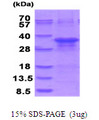 ZFAND5 Protein
