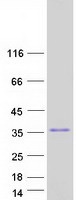 ZFAND5 Protein - Purified recombinant protein ZFAND5 was analyzed by SDS-PAGE gel and Coomassie Blue Staining