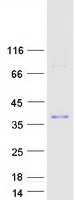 ZFAND5 Protein - Purified recombinant protein ZFAND5 was analyzed by SDS-PAGE gel and Coomassie Blue Staining