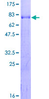 ZFC3H1 Protein - 12.5% SDS-PAGE of human PSRC2 stained with Coomassie Blue