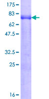 ZFC3H1 Protein - 12.5% SDS-PAGE of human PSRC2 stained with Coomassie Blue