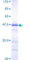ZFHX3 / ATBF1 Protein - 12.5% SDS-PAGE Stained with Coomassie Blue.