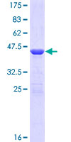 ZFHX4 Protein - 12.5% SDS-PAGE Stained with Coomassie Blue.