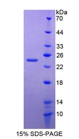 ZFHX4 Protein - Recombinant Zinc Finger Homeobox Protein 4 By SDS-PAGE