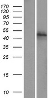 ZFP1 Protein - Western validation with an anti-DDK antibody * L: Control HEK293 lysate R: Over-expression lysate
