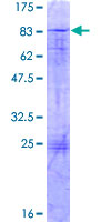 ZFP161 Protein - 12.5% SDS-PAGE of human ZFP161 stained with Coomassie Blue