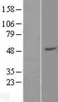 ZFP2 Protein - Western validation with an anti-DDK antibody * L: Control HEK293 lysate R: Over-expression lysate