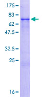 ZFP2 Protein - 12.5% SDS-PAGE of human ZFP2 stained with Coomassie Blue