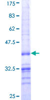 ZFP219 / ZNF219 Protein - 12.5% SDS-PAGE Stained with Coomassie Blue.