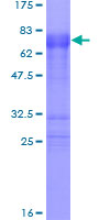 ZFP36 / Tristetraprolin Protein - 12.5% SDS-PAGE of human ZFP36 stained with Coomassie Blue