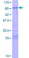 ZFP36L2 Protein - 12.5% SDS-PAGE of human ZFP36L2 stained with Coomassie Blue