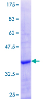 ZFP37 Protein - 12.5% SDS-PAGE Stained with Coomassie Blue.