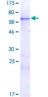 ZFP42 / REX-1 Protein - 12.5% SDS-PAGE of human ZFP42 stained with Coomassie Blue