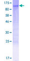 ZFP64 Protein - 12.5% SDS-PAGE of human ZFP64 stained with Coomassie Blue