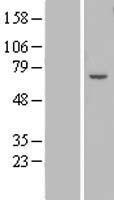 ZFP82 / ZNF545 Protein - Western validation with an anti-DDK antibody * L: Control HEK293 lysate R: Over-expression lysate