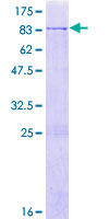 ZFP82 / ZNF545 Protein - 12.5% SDS-PAGE of human ZNF545 stained with Coomassie Blue