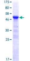 ZFP90 Protein - 12.5% SDS-PAGE of human ZFP90 stained with Coomassie Blue