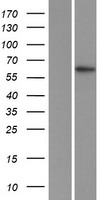 ZFP91 Protein - Western validation with an anti-DDK antibody * L: Control HEK293 lysate R: Over-expression lysate