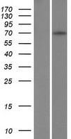 ZFY Protein - Western validation with an anti-DDK antibody * L: Control HEK293 lysate R: Over-expression lysate