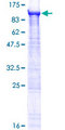 ZFYVE1 / DFCP1 Protein - 12.5% SDS-PAGE of human ZFYVE1 stained with Coomassie Blue