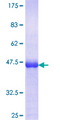 ZFYVE1 / DFCP1 Protein - 12.5% SDS-PAGE Stained with Coomassie Blue.