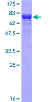 ZFYVE19 Protein - 12.5% SDS-PAGE of human ZFYVE19 stained with Coomassie Blue