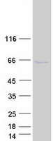 ZFYVE19 Protein - Purified recombinant protein ZFYVE19 was analyzed by SDS-PAGE gel and Coomassie Blue Staining