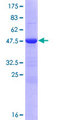 ZFYVE21 Protein - 12.5% SDS-PAGE of human ZFYVE21 stained with Coomassie Blue