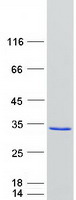 ZFYVE21 Protein - Purified recombinant protein ZFYVE21 was analyzed by SDS-PAGE gel and Coomassie Blue Staining