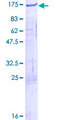 ZFYVE28 Protein - 12.5% SDS-PAGE of human ZFYVE28 stained with Coomassie Blue