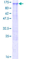 ZFYVE9 / SARA Protein - 12.5% SDS-PAGE of human ZFYVE9 stained with Coomassie Blue