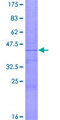 ZG16 Protein - 12.5% SDS-PAGE of human ZG16 stained with Coomassie Blue