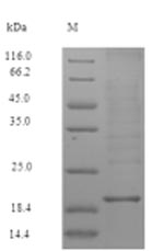ZG16B Protein - (Tris-Glycine gel) Discontinuous SDS-PAGE (reduced) with 5% enrichment gel and 15% separation gel.