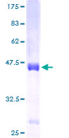 ZG16B Protein - 12.5% SDS-PAGE of human LOC124220 stained with Coomassie Blue