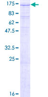 ZHX1 Protein - 12.5% SDS-PAGE of human ZHX1 stained with Coomassie Blue