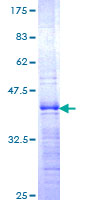 ZHX1 Protein - 12.5% SDS-PAGE Stained with Coomassie Blue.