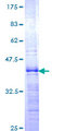ZHX1 Protein - 12.5% SDS-PAGE Stained with Coomassie Blue.