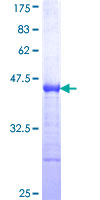 ZHX2 / RAF Protein - 12.5% SDS-PAGE Stained with Coomassie Blue.