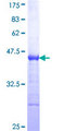 ZHX2 / RAF Protein - 12.5% SDS-PAGE Stained with Coomassie Blue.