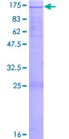 ZHX3 Protein - 12.5% SDS-PAGE of human ZHX3 stained with Coomassie Blue