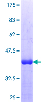 ZHX3 Protein - 12.5% SDS-PAGE Stained with Coomassie Blue.