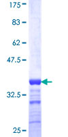 ZIC / ZIC1 Protein - 12.5% SDS-PAGE Stained with Coomassie Blue.