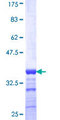 ZIC / ZIC1 Protein - 12.5% SDS-PAGE Stained with Coomassie Blue.
